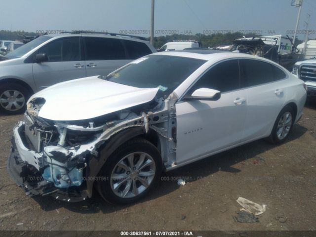 Photo 1 VIN: 1G1ZD5ST6LF007528 - CHEVROLET MALIBU 