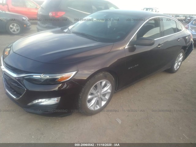 Photo 1 VIN: 1G1ZD5ST6LF017265 - CHEVROLET MALIBU 