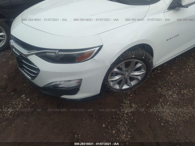 Photo 5 VIN: 1G1ZD5ST6LF146137 - CHEVROLET MALIBU 