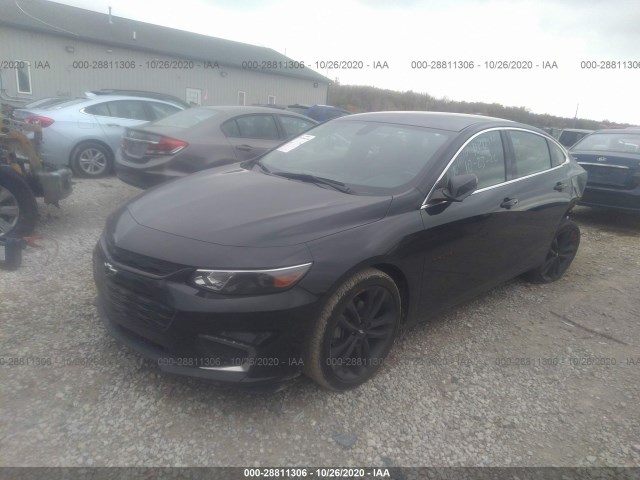 Photo 1 VIN: 1G1ZD5ST7JF285643 - CHEVROLET MALIBU 