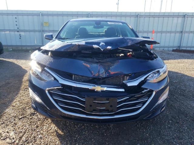 Photo 4 VIN: 1G1ZD5ST7LF021907 - CHEVROLET MALIBU LT 