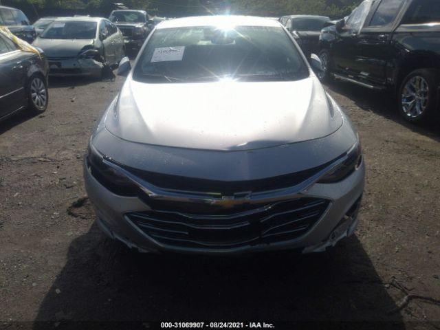 Photo 5 VIN: 1G1ZD5ST7MF008205 - CHEVROLET MALIBU 