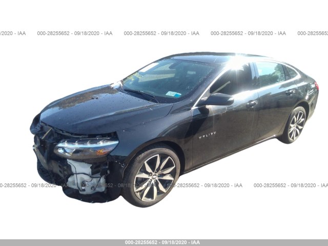 Photo 1 VIN: 1G1ZD5ST8JF284632 - CHEVROLET MALIBU 