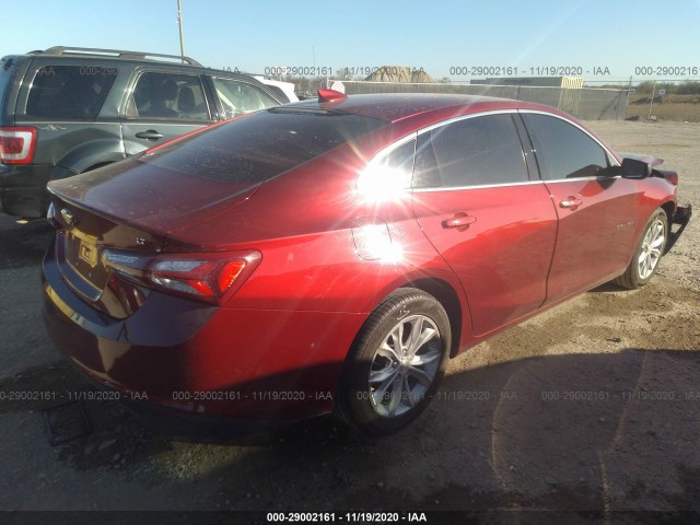 Photo 3 VIN: 1G1ZD5ST8LF004632 - CHEVROLET MALIBU 