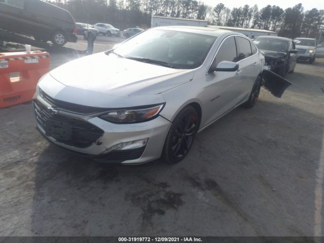 Photo 1 VIN: 1G1ZD5ST8LF151503 - CHEVROLET MALIBU 