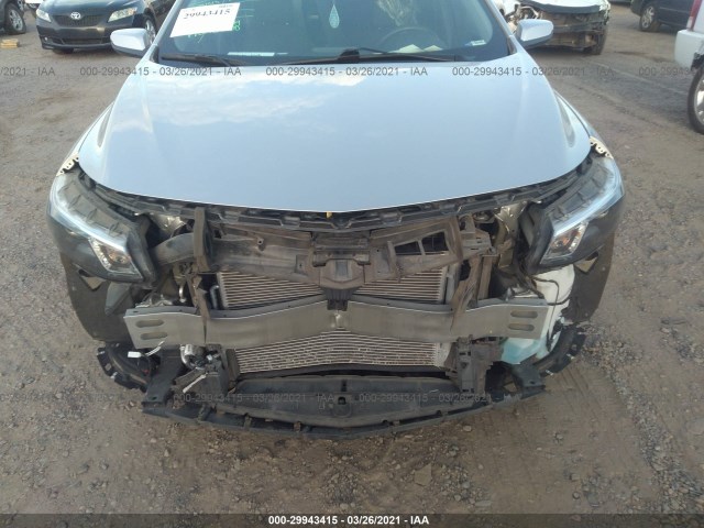 Photo 5 VIN: 1G1ZD5ST9JF129393 - CHEVROLET MALIBU 