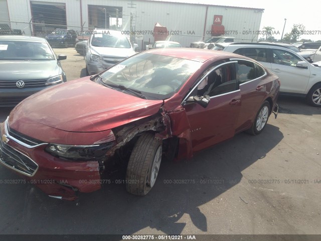 Photo 1 VIN: 1G1ZD5ST9JF138658 - CHEVROLET MALIBU 