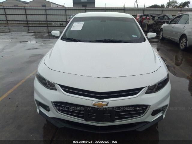 Photo 5 VIN: 1G1ZD5ST9JF155038 - CHEVROLET MALIBU 