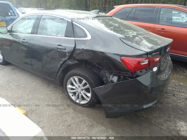 Photo 5 VIN: 1G1ZD5ST9JF174043 - CHEVROLET MALIBU 