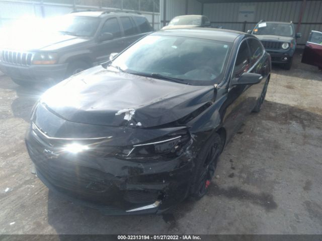 Photo 1 VIN: 1G1ZD5ST9JF255527 - CHEVROLET MALIBU 