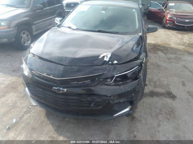 Photo 5 VIN: 1G1ZD5ST9JF255527 - CHEVROLET MALIBU 