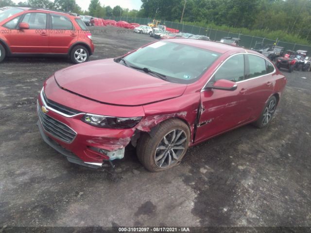 Photo 1 VIN: 1G1ZD5ST9JF291864 - CHEVROLET MALIBU 