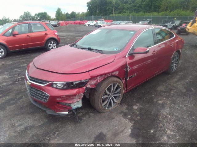 Photo 5 VIN: 1G1ZD5ST9JF291864 - CHEVROLET MALIBU 