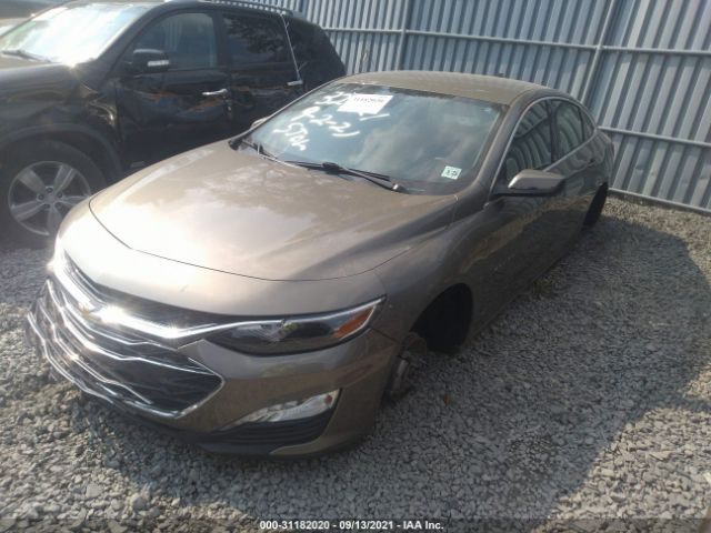 Photo 1 VIN: 1G1ZD5ST9LF004610 - CHEVROLET MALIBU 