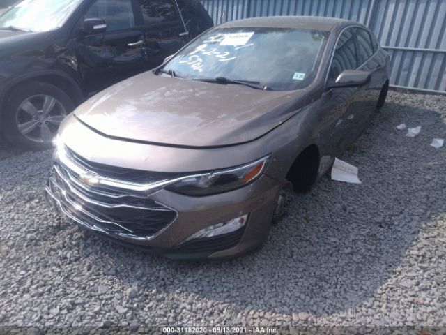 Photo 5 VIN: 1G1ZD5ST9LF004610 - CHEVROLET MALIBU 