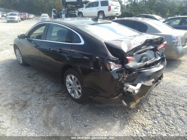 Photo 2 VIN: 1G1ZD5ST9LF052589 - CHEVROLET MALIBU 