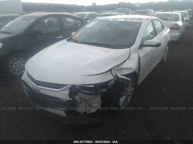 Photo 5 VIN: 1G1ZD5STXJF107015 - CHEVROLET MALIBU 