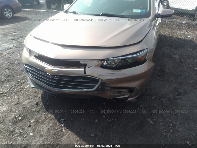 Photo 5 VIN: 1G1ZD5STXJF144131 - CHEVROLET MALIBU 