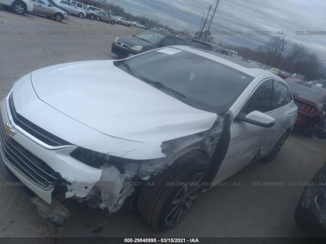 Photo 1 VIN: 1G1ZD5STXJF159888 - CHEVROLET MALIBU 