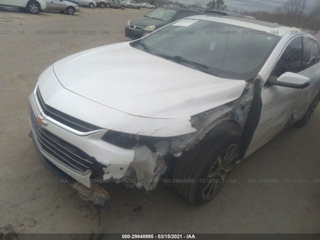 Photo 5 VIN: 1G1ZD5STXJF159888 - CHEVROLET MALIBU 