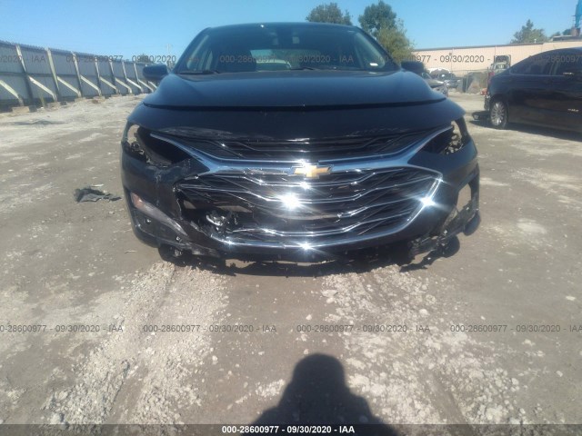 Photo 5 VIN: 1G1ZD5STXKF139027 - CHEVROLET MALIBU 