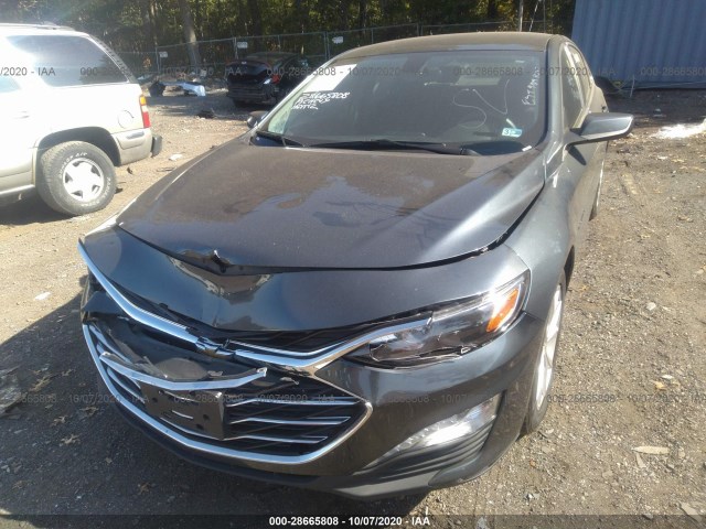 Photo 5 VIN: 1G1ZD5STXKF171511 - CHEVROLET MALIBU 