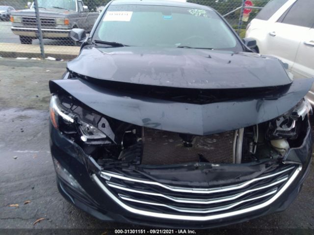 Photo 5 VIN: 1G1ZD5STXKF171685 - CHEVROLET MALIBU 