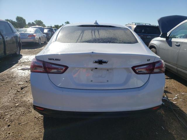 Photo 5 VIN: 1G1ZD5STXLF034988 - CHEVROLET MALIBU 