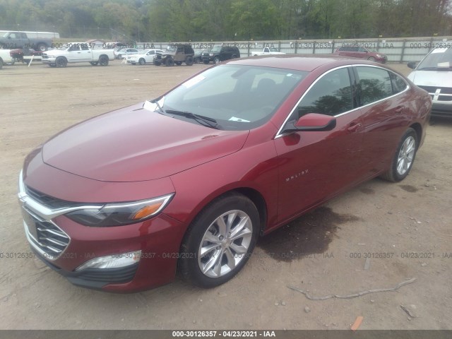 Photo 1 VIN: 1G1ZD5STXLF051676 - CHEVROLET MALIBU 