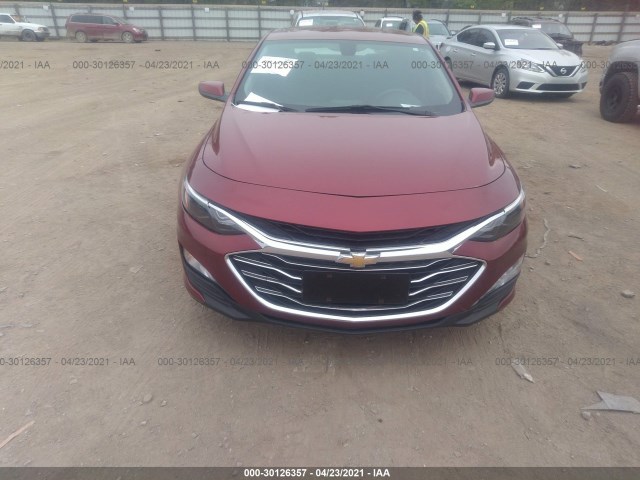 Photo 5 VIN: 1G1ZD5STXLF051676 - CHEVROLET MALIBU 