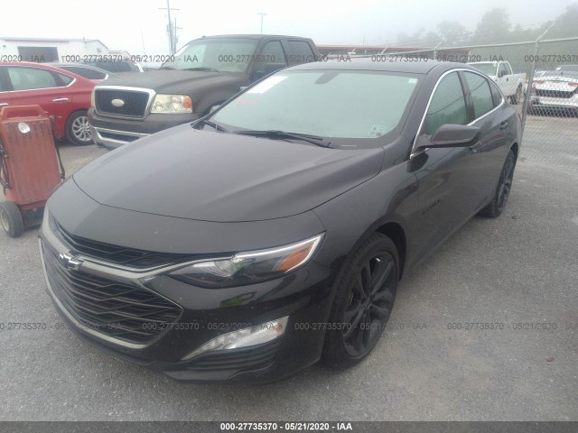 Photo 1 VIN: 1G1ZD5STXLF079896 - CHEVROLET MALIBU 