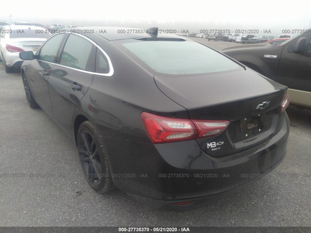 Photo 2 VIN: 1G1ZD5STXLF079896 - CHEVROLET MALIBU 