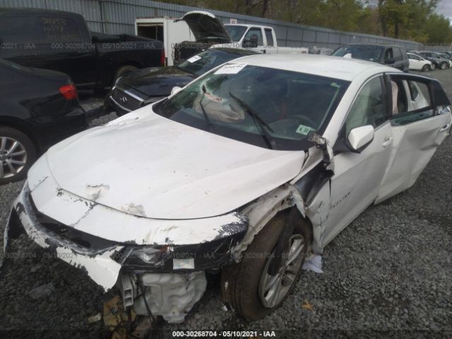 Photo 5 VIN: 1G1ZE5ST0HF125059 - CHEVROLET MALIBU 