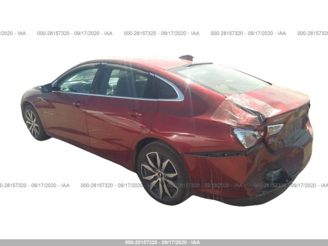 Photo 2 VIN: 1G1ZE5ST2HF224384 - CHEVROLET MALIBU 