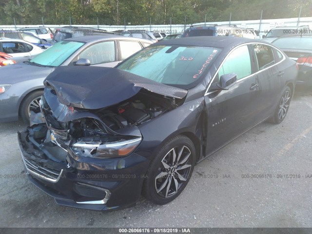 Photo 1 VIN: 1G1ZE5STXHF243796 - CHEVROLET MALIBU 