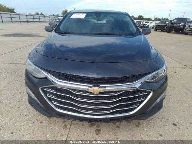 Photo 5 VIN: 1G1ZE5SX9LF076679 - CHEVROLET MALIBU 