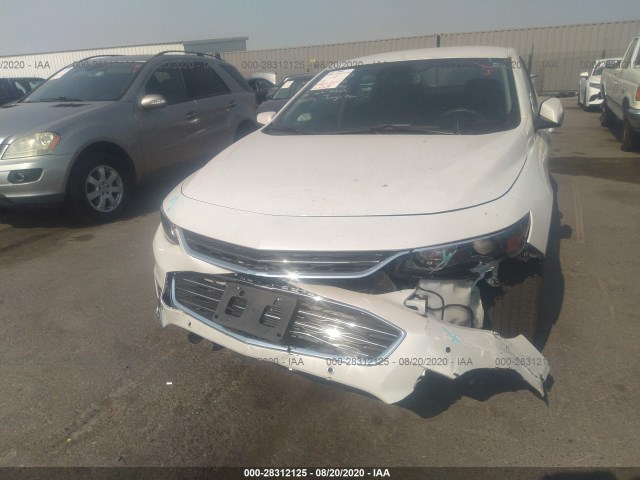 Photo 5 VIN: 1G1ZF5SU6JF291680 - CHEVROLET MALIBU 