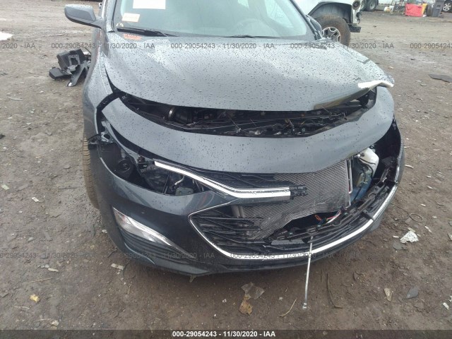 Photo 5 VIN: 1G1ZG5ST4LF140621 - CHEVROLET MALIBU 