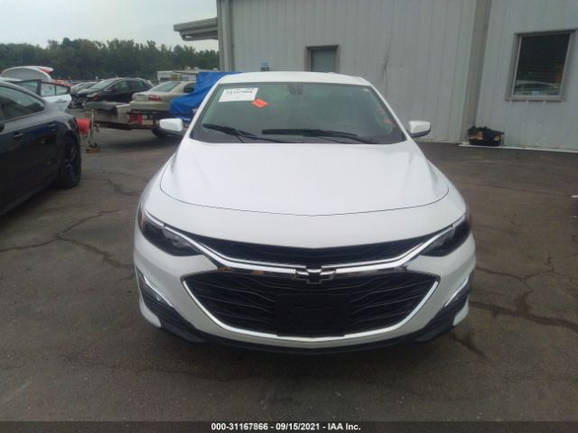 Photo 5 VIN: 1G1ZG5ST8LF124485 - CHEVROLET MALIBU 