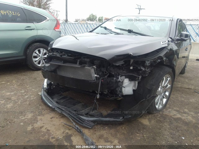 Photo 5 VIN: 1G4GB5G30EF155069 - BUICK LACROSSE 