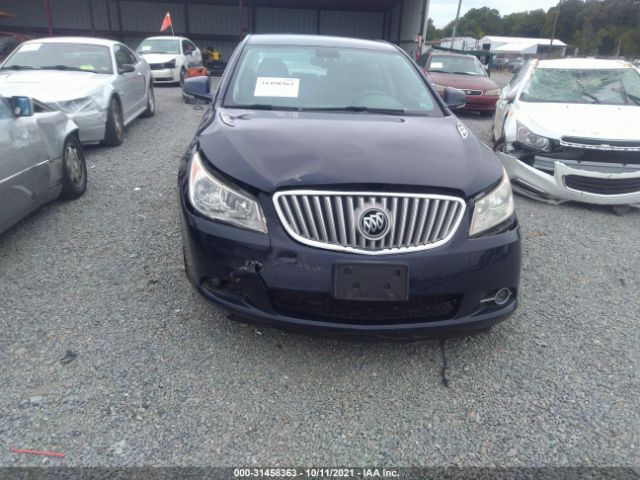 Photo 5 VIN: 1G4GC5ED0BF149485 - BUICK LACROSSE 