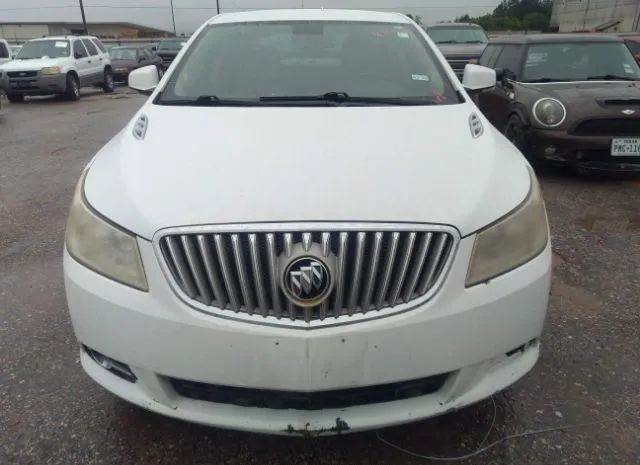 Photo 5 VIN: 1G4GC5EG5AF160023 - BUICK LACROSSE 