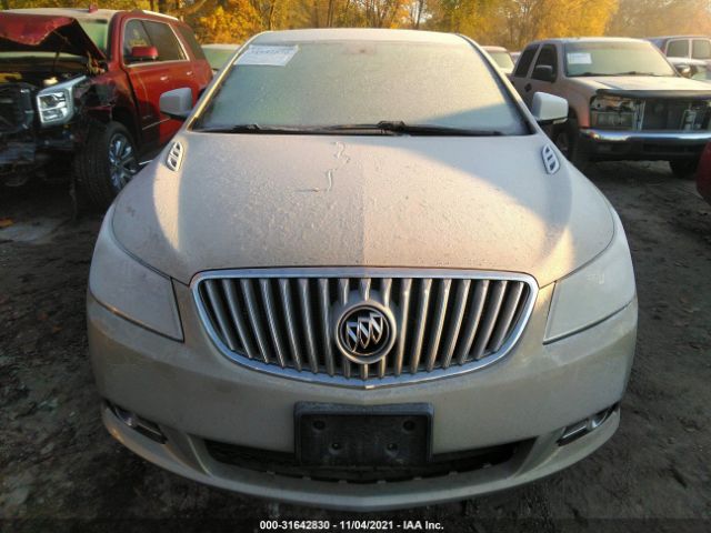 Photo 5 VIN: 1G4GD5E3XCF265234 - BUICK LACROSSE 