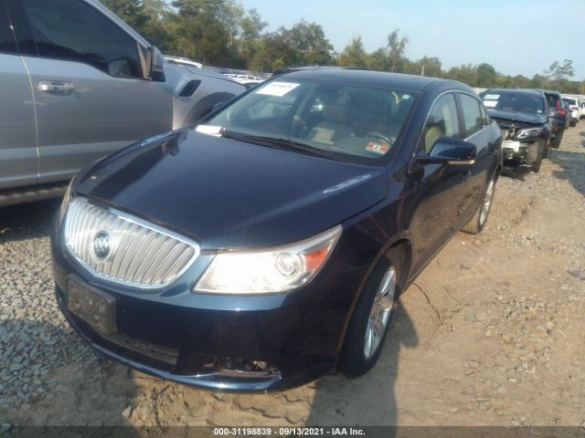 Photo 1 VIN: 1G4GD5EGXAF176053 - BUICK LACROSSE 