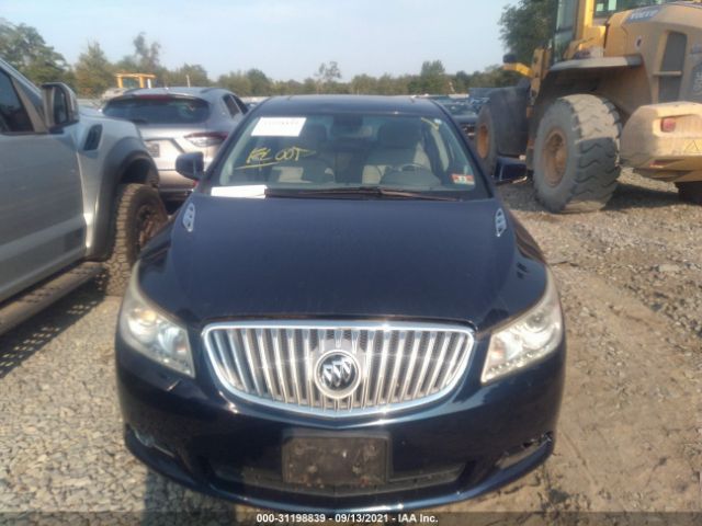 Photo 5 VIN: 1G4GD5EGXAF176053 - BUICK LACROSSE 