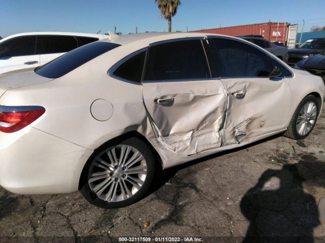 Photo 5 VIN: 1G4PP5SK1E4136431 - BUICK VERANO 