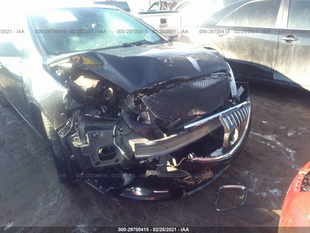 Photo 5 VIN: 1G4PP5SK1E4166707 - BUICK VERANO 