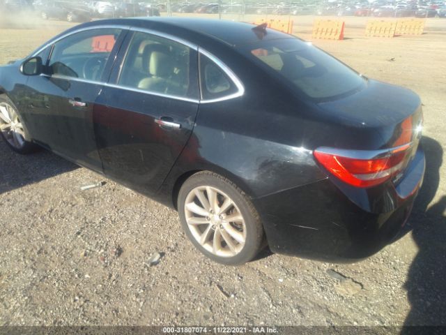 Photo 2 VIN: 1G4PP5SK2C4155406 - BUICK VERANO 