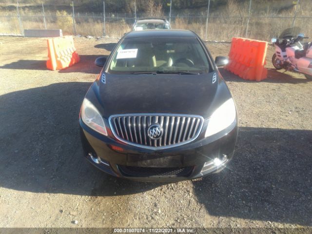 Photo 5 VIN: 1G4PP5SK2C4155406 - BUICK VERANO 