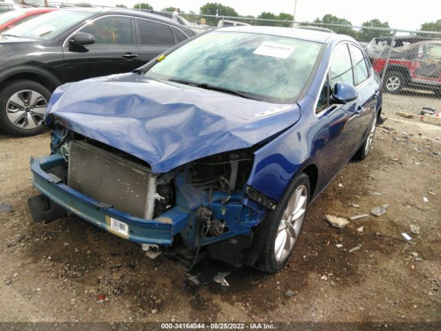 Photo 1 VIN: 1G4PP5SK2E4100859 - BUICK VERANO 